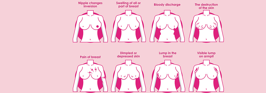 Changes in the Nipple During Breast Cancer