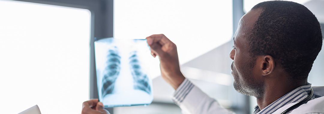 Lung Cancer - Symptoms, Diagnosis, Treatment & More