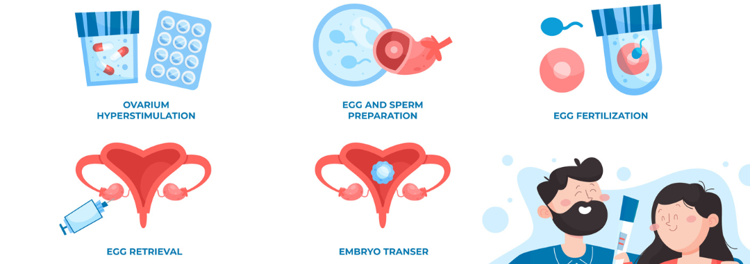 How IVF Works- Step by Step IVF Procedure