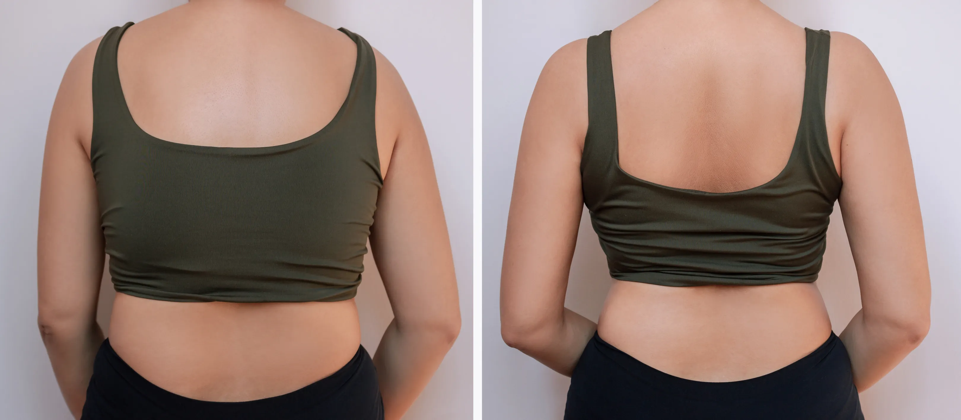 Best Hospitals for Mommy Makeover in the World 2026