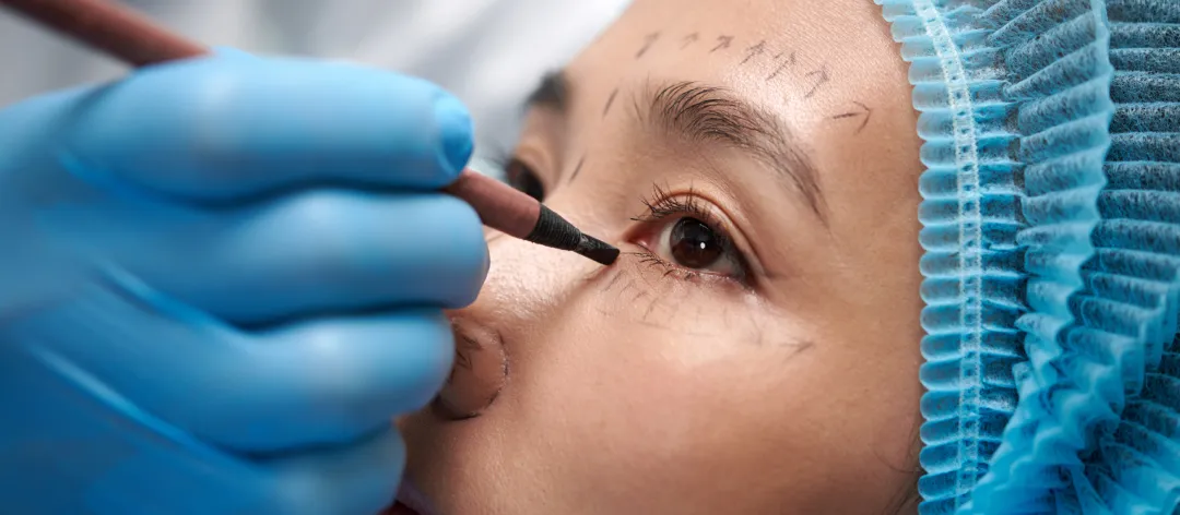 Best Plastic Surgery Hospitals in South Korea for International Patients