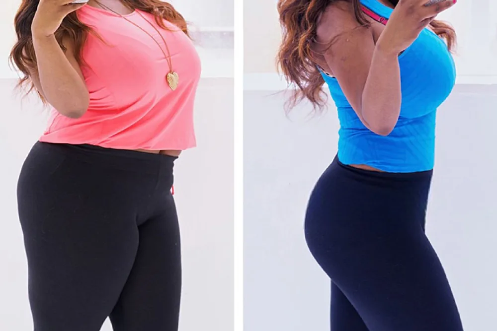 Is It Safe to Have a Tummy Tuck in Turkey? Mummy Makeover Plan