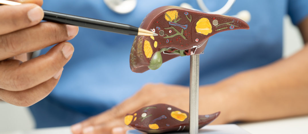Liver Transplant Cost: India vs Turkey vs Thailand 2026