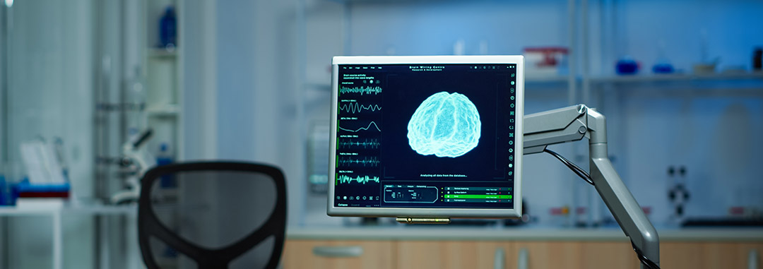 Medical monitor showcasing a brain scan, highlighting neuroimaging technology for brain health diagnostics.