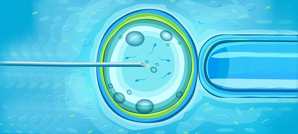 The Ultimate Guide to the IVF Process