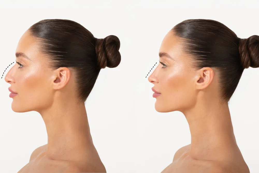 You Matter Most: Personalised Plastic Surgery Focused on You