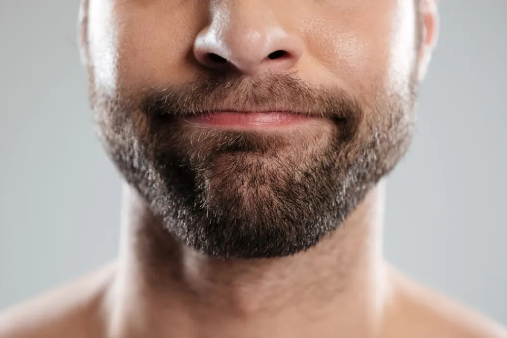 Beard Transplantation