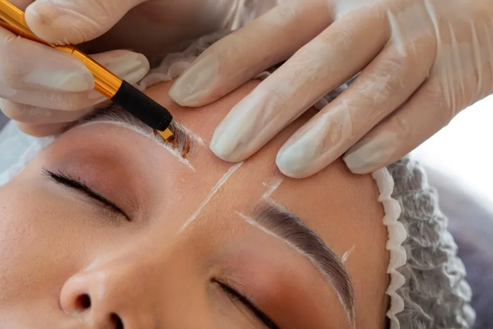 Eyebrow Transplantation