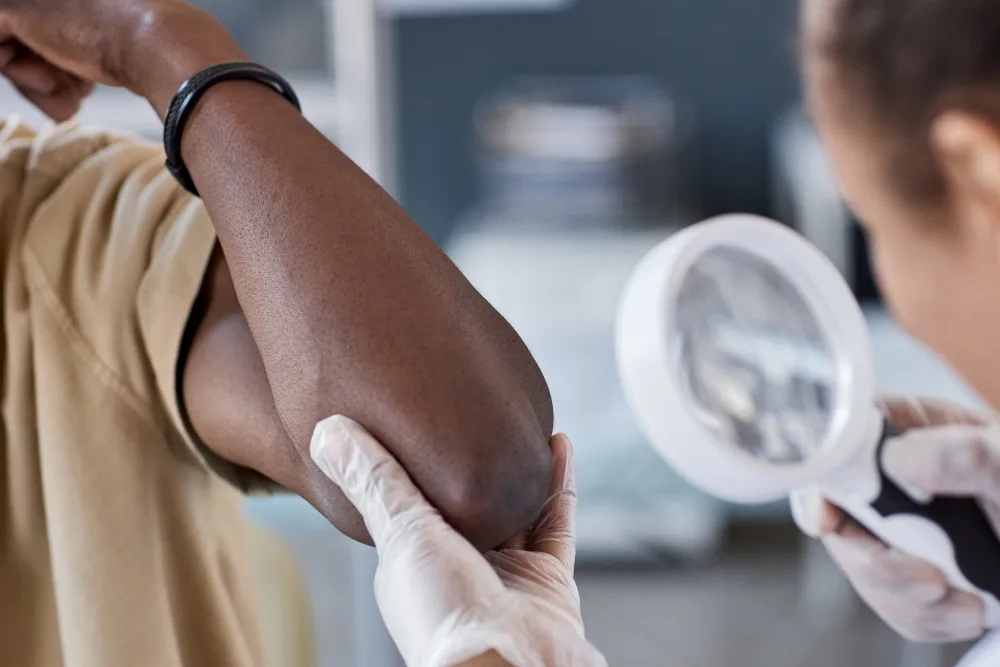 Skin Allergy Testing Package