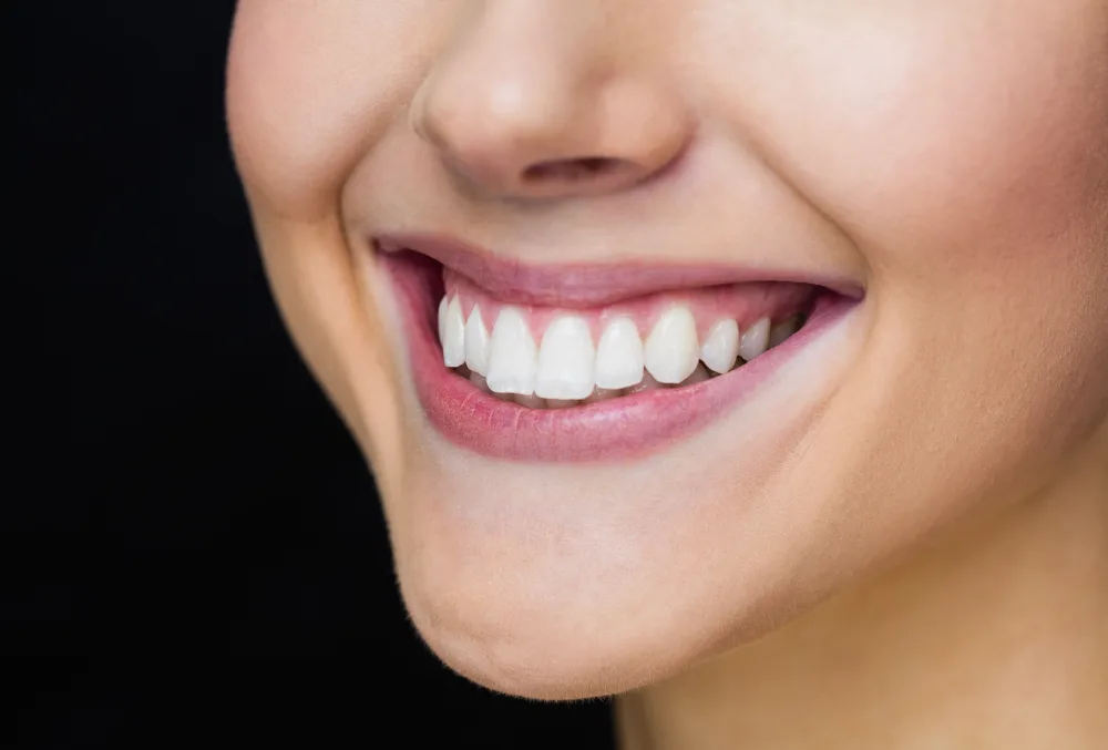 Zirconium Smile Makeover